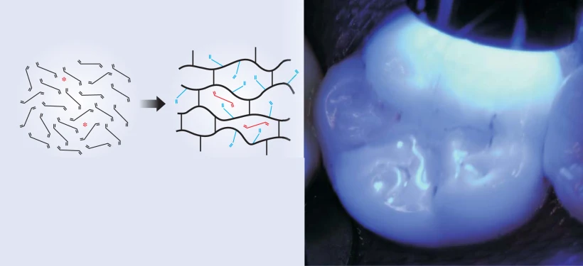 Shining a light on dental composite restoratives — graphical abstract